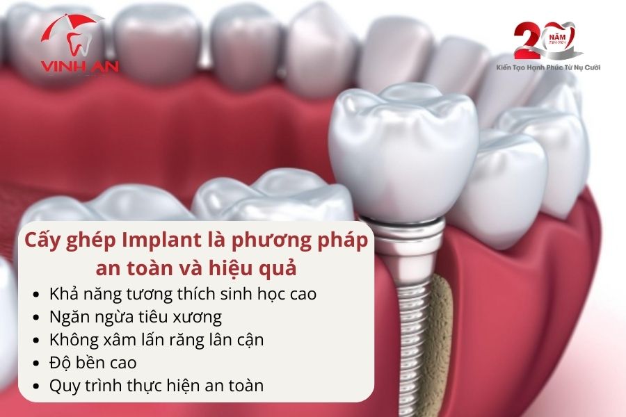 Tác Hại Trồng Răng Implant Giá Rẻ