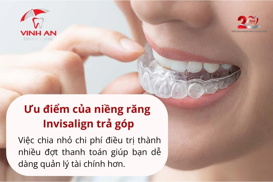 Niềng Răng Invisalign Trả Góp