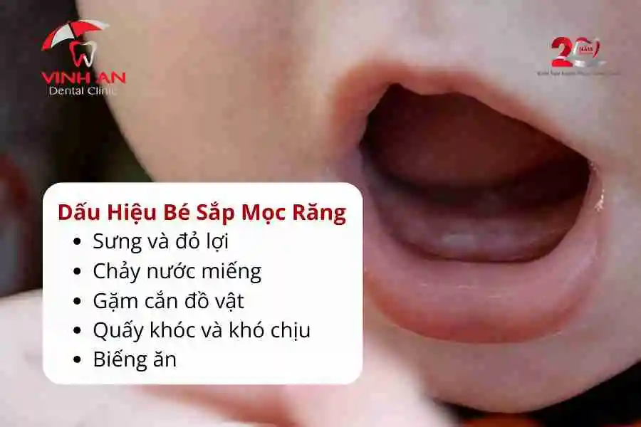 Bé-mọc-răng