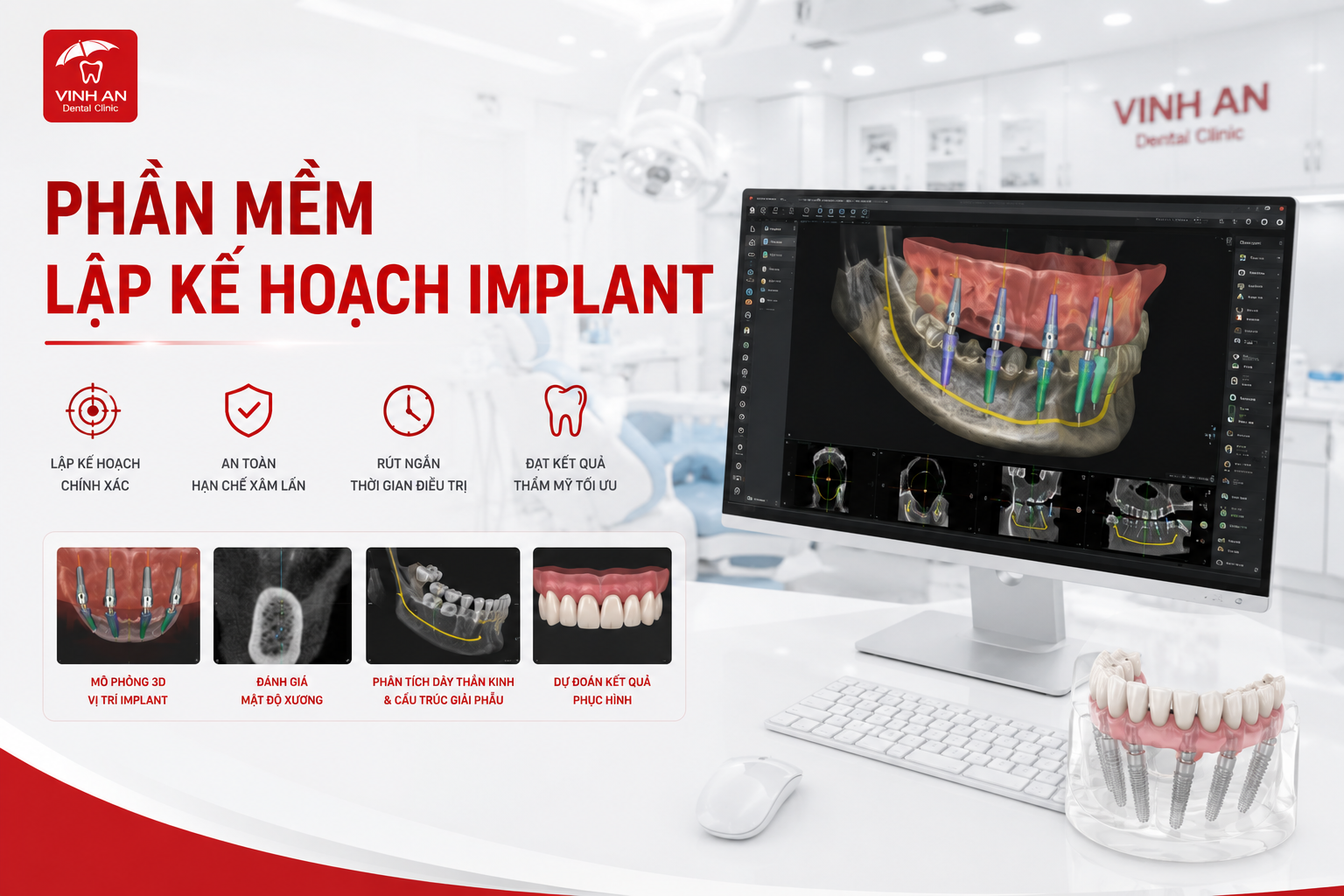Phần Mềm Lập Kế Hoạch Implant