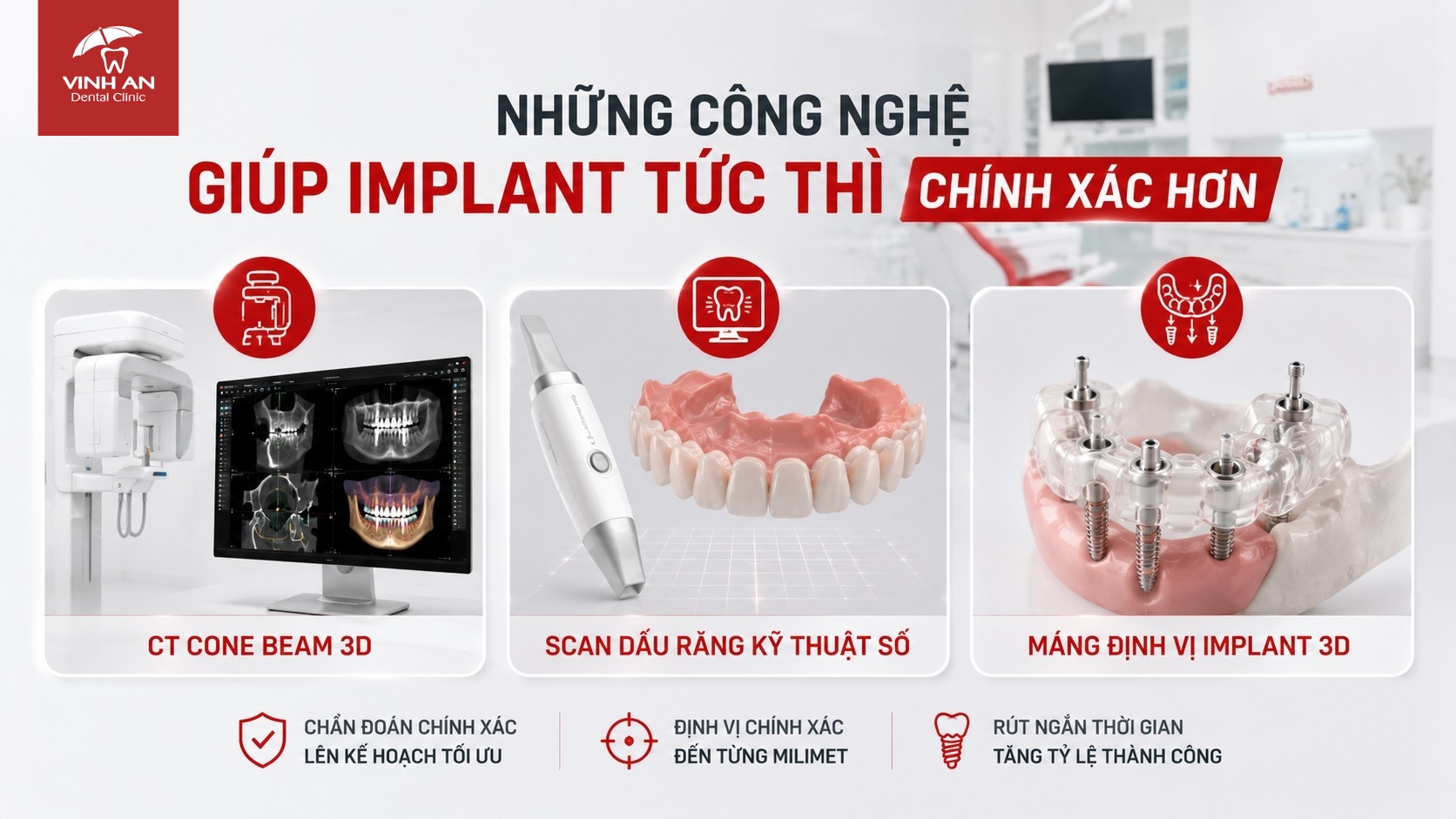 Những Công Nghệ Giúp Implant Tức Thì Chính Xác Hơn