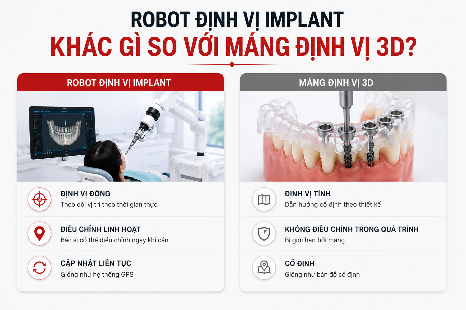 Robot Định Vị Implant Khác Gì So Với Máng Định Vị 3D?