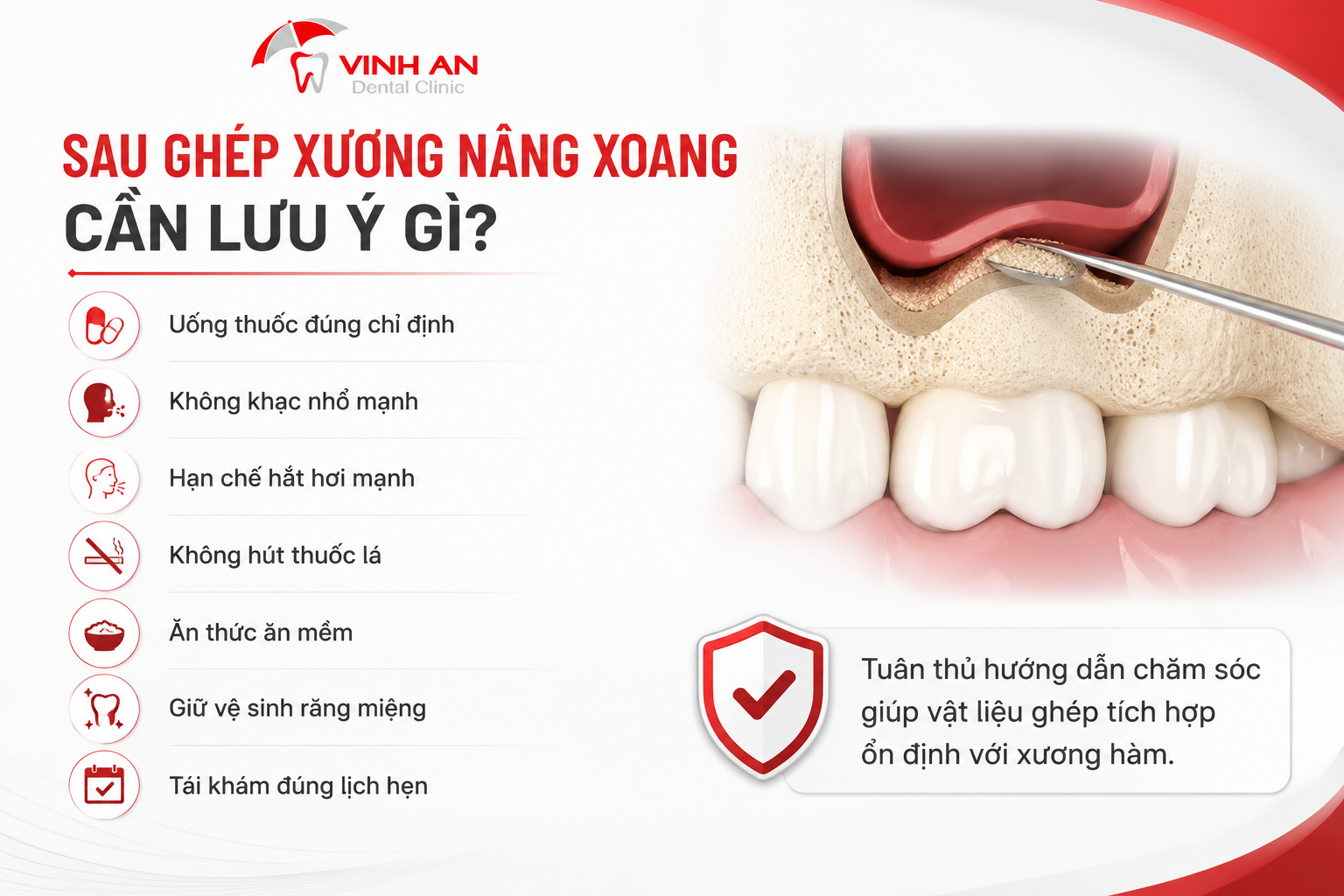Sau Ghép Xương Nâng Xoang Cần Lưu Ý Gì?