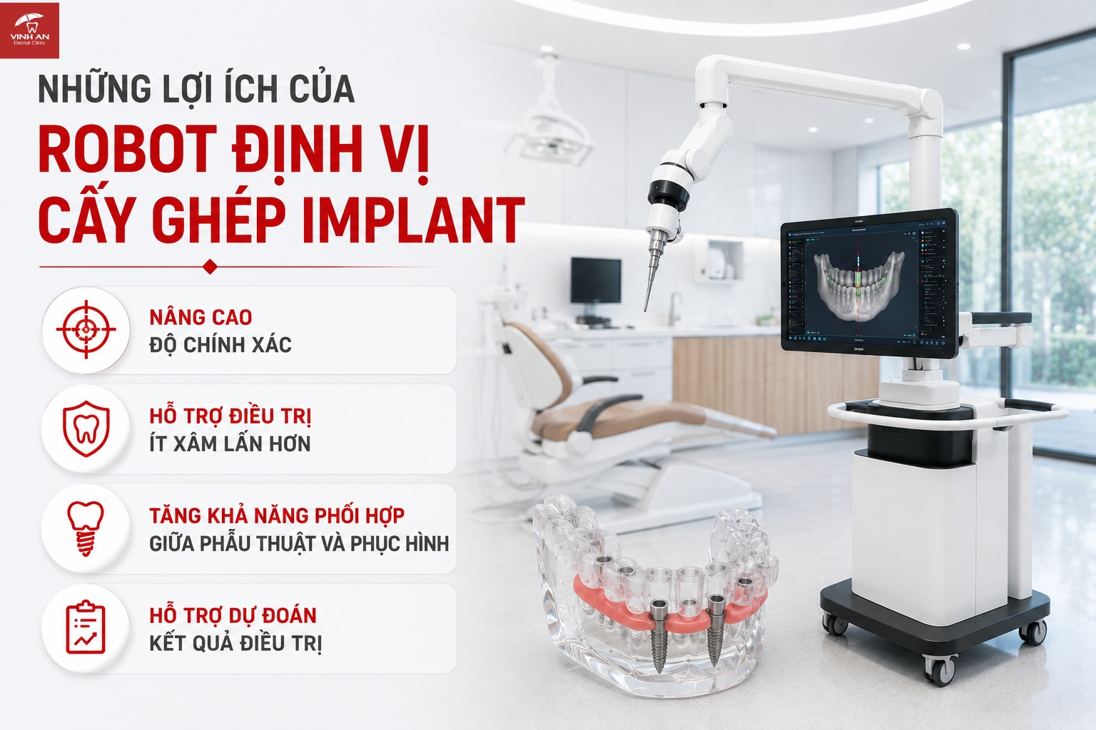 Những Lợi Ích Của Robot Định Vị Cấy Ghép Implant
