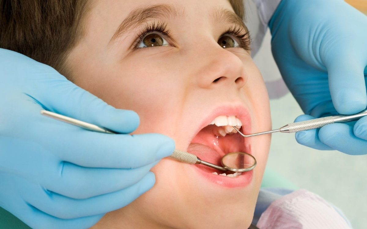 Vì Sao Khám Răng Định Kỳ Quan Trọng Với Trẻ?