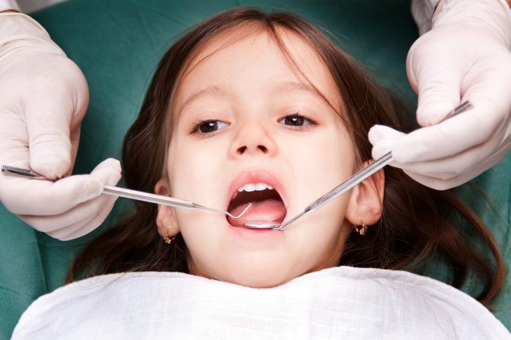 Nhổ Răng Sữa Theo Chỉ Định