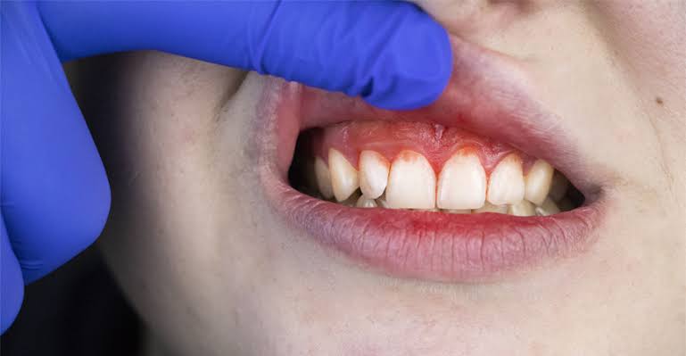 Periodontist