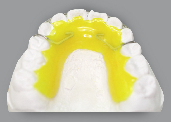 trồng răng implantlàm răng giả bằng Implant uy tín