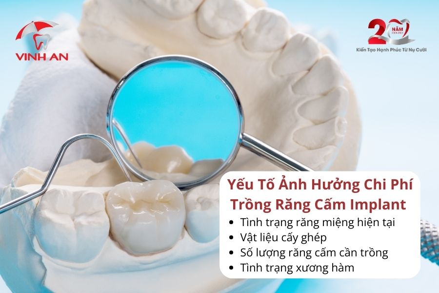 Giatrongrangcamimplant4