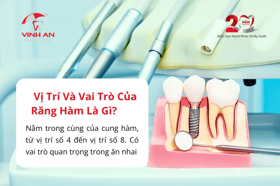 Trồng Răng Hàm Implant1