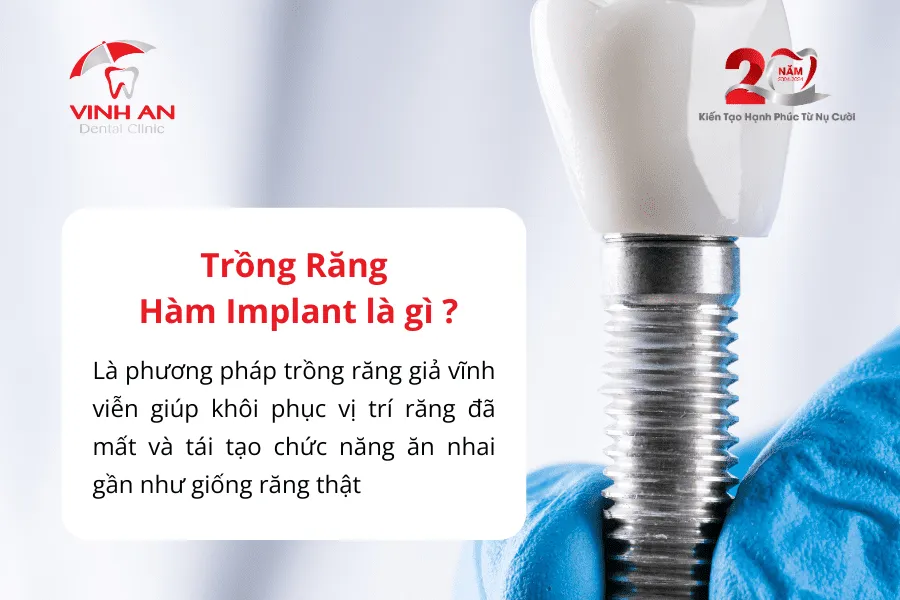 Trồng Răng Hàm Implant3