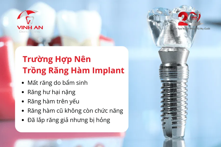 Trồng Răng Hàm Implant6