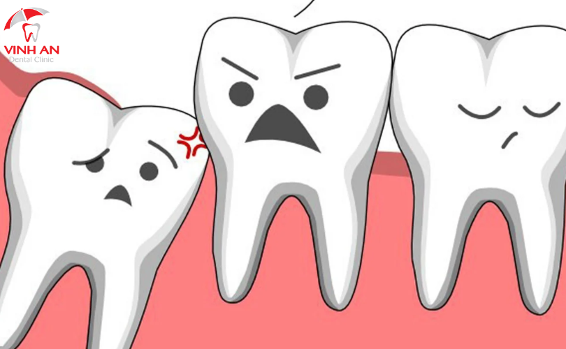 nhổ răng khôn có ảnh hưởng gì không