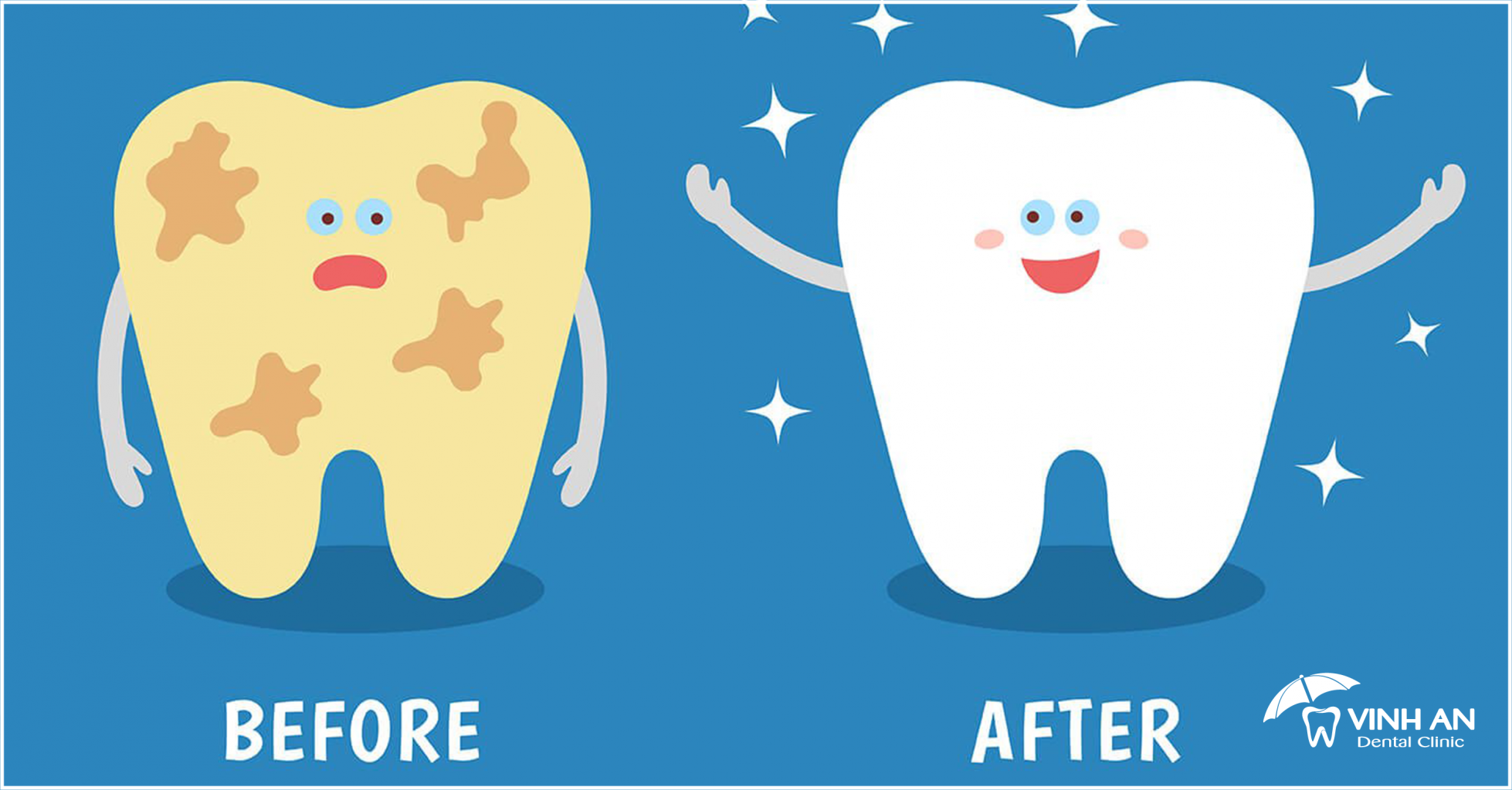 13+ cách làm sạch mảng bám trên răng hiệu quả trong 2 phút ít người biết