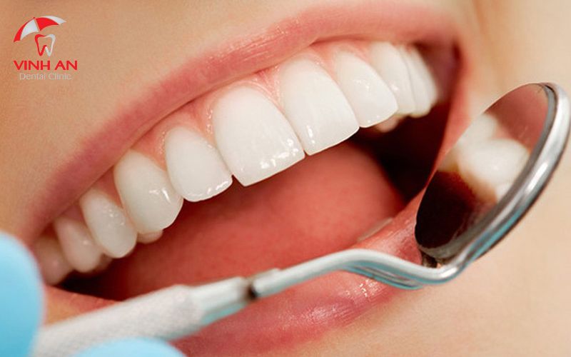 So sánh răng sứ Cercon Zirconia với Cercon HT