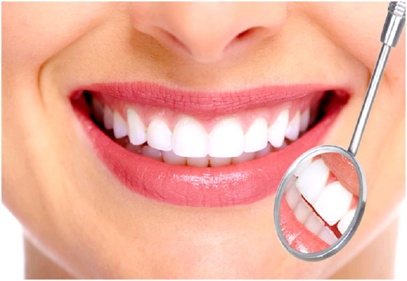 Boc răng sứ để cải thiện nụ cười xâu