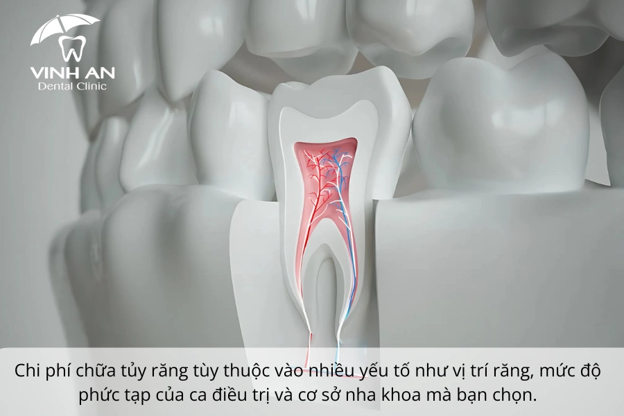 Chi-phi-lay-tuy-rang