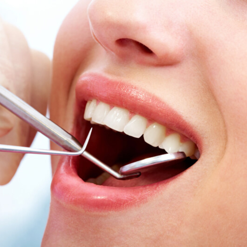 Ảnh hưởng của nhổ răng hàm sai cách