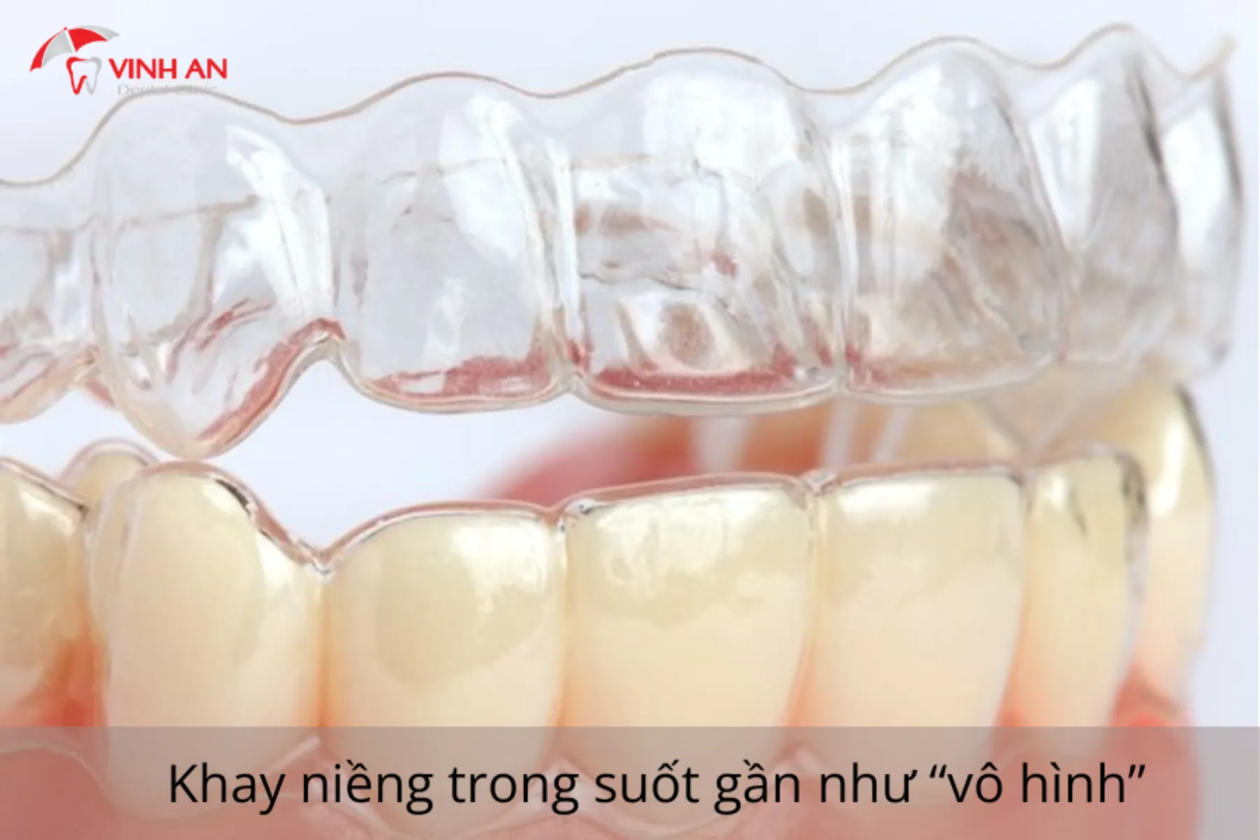 Nieng-rang-trong-suot (7)