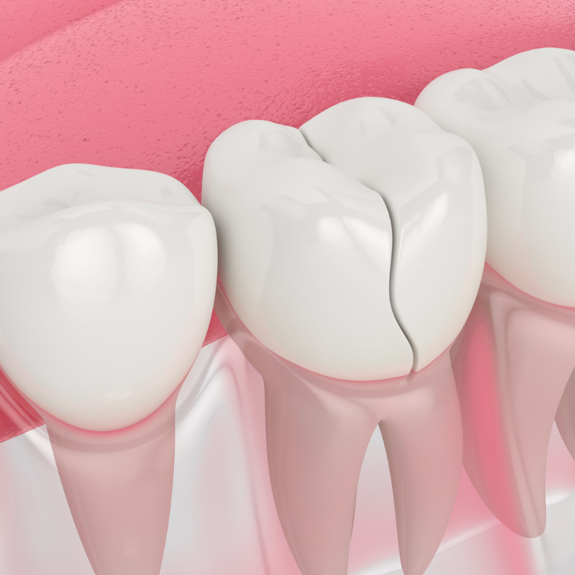 Hậu quả của đau răng hàm
