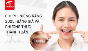 Chi Phí Niềng Răng