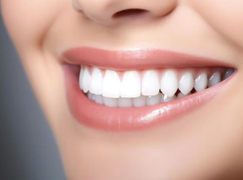 Mẫu Răng Sứ đẹp 2