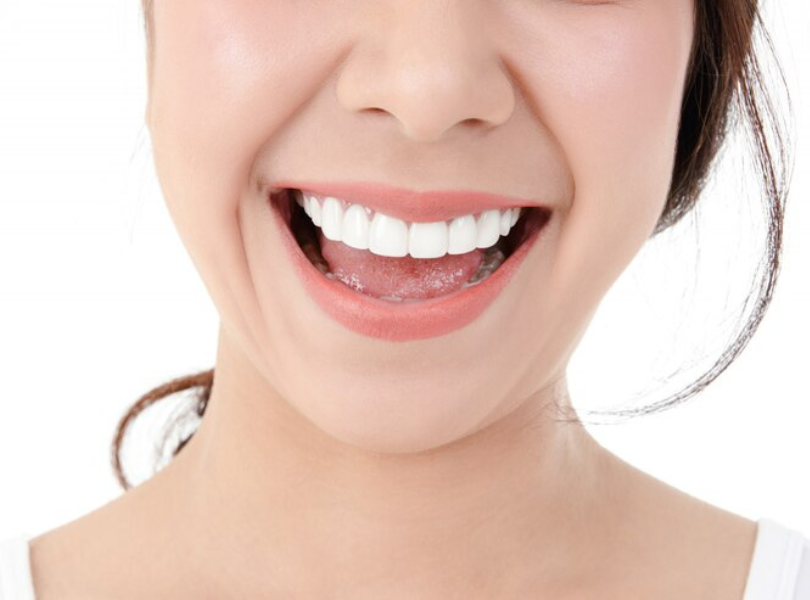 Mẫu Răng Sứ đẹp 3