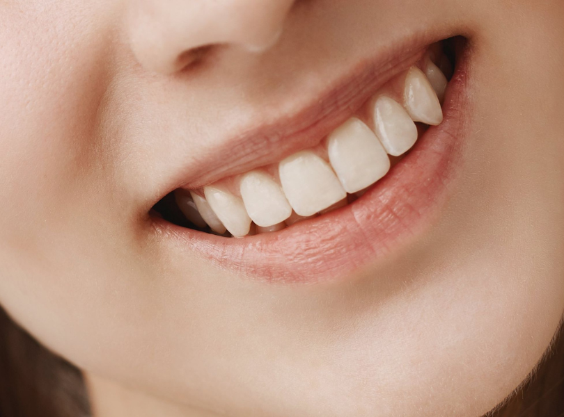 Mẫu Răng Sứ đẹp 6