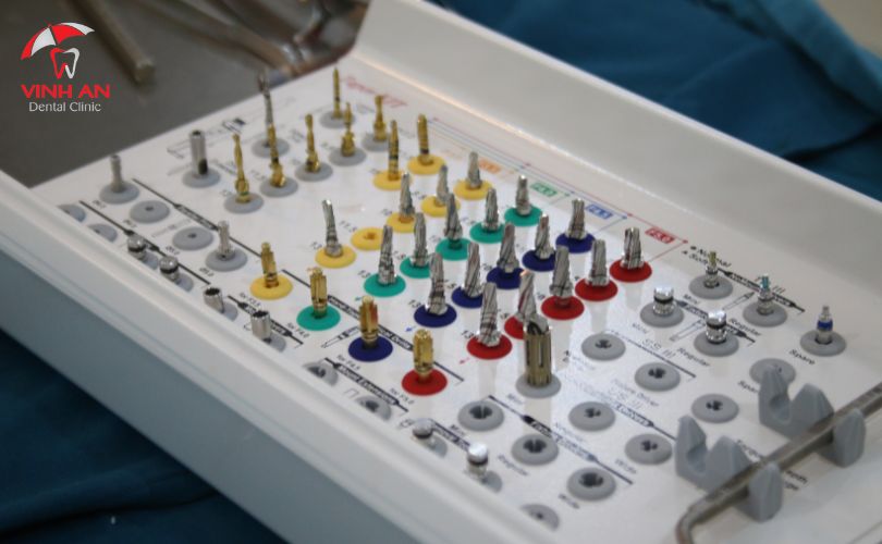 Trồng Răng Implant Có Nguy Hiểm Không? Những Biến Chứng Bạn Có Thể Gặp