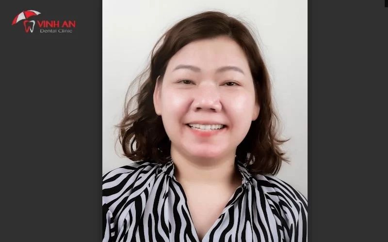Review Từ Khách Hàng đã Trồng Răng Implant
