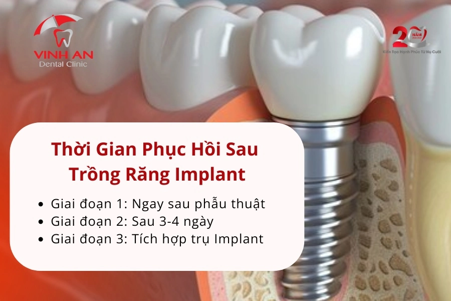 Trồng Răng Implant Có đau Không