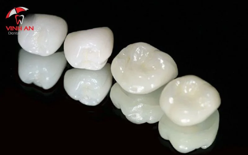 Thực hiện mài răng và lấy dấu mẫu hàm