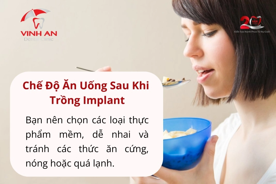 Lưu ý Khi Trồng Răng Implant