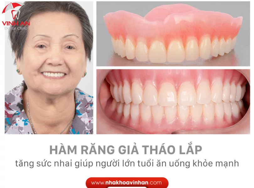 Nha Khoa Quan 10- (12)