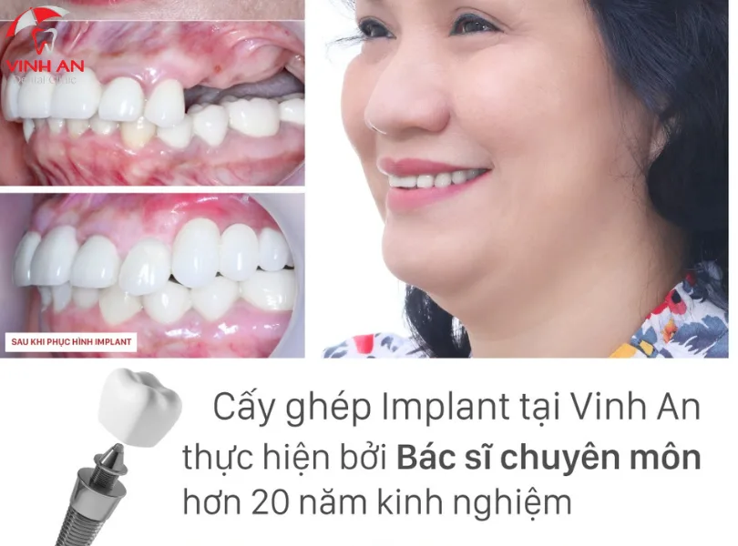 Nha Khoa Quan 1020