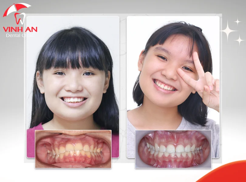 Nha Khoa Quan 10