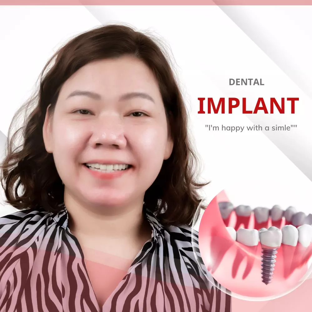 Vinh An Implant Clinic