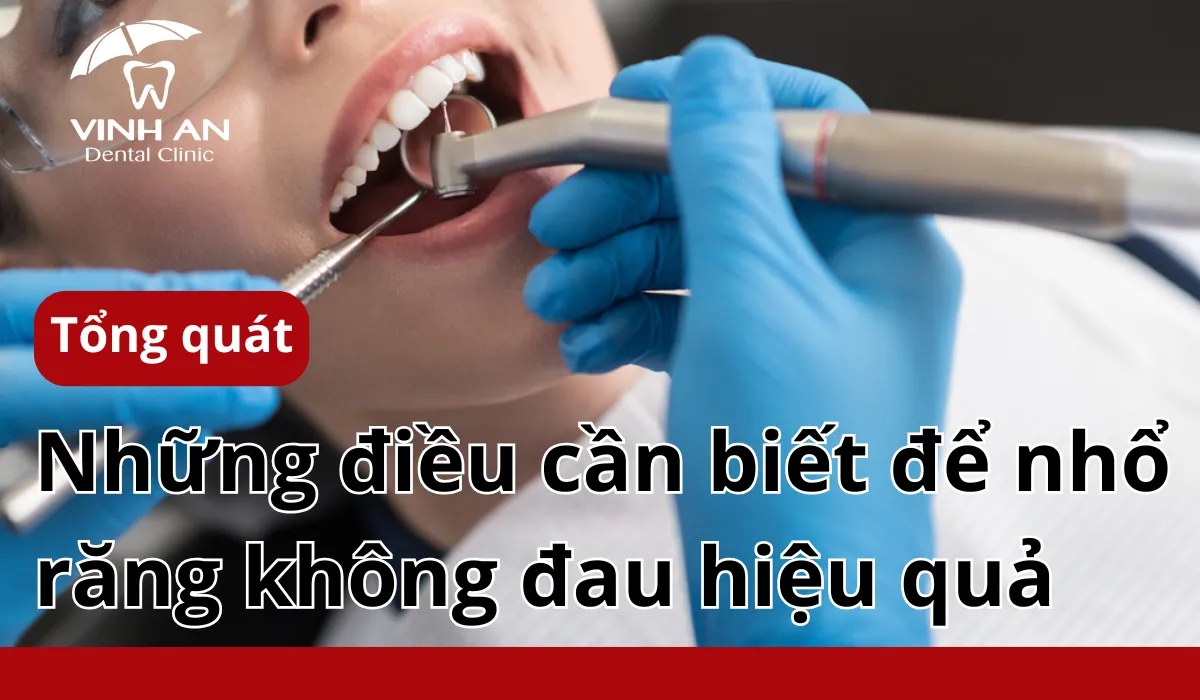 Những điều Cần Biết để Nhổ Răng Không đau Hiệu Quả