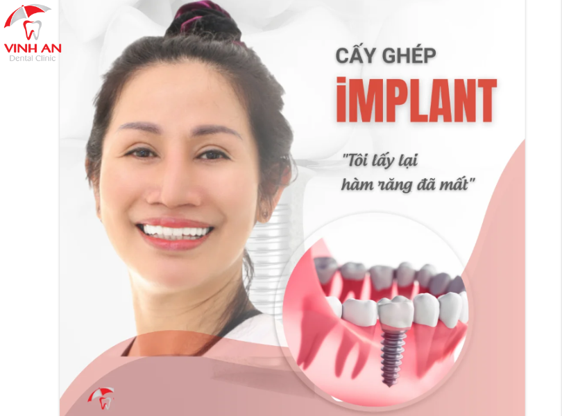 Sau Khi Trồng Răng Implant Có Bị Hôi Miệng Không ?1