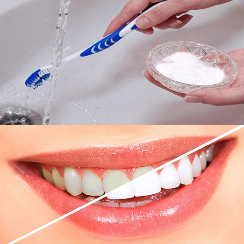 Tips sử dụng thuốc tẩy trắng răng đúng cách 