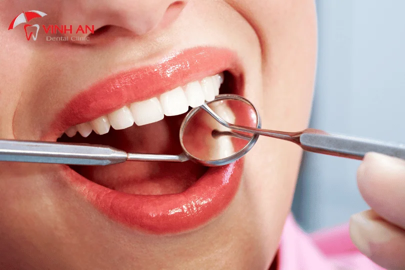 các bệnh viện răng hàm mặt ở tphcm, bệnh viện nha khoa, bệnh viện răng hàm mặt nào tốt nhất, nha khoa răng hàm mặt, review bệnh viện răng hàm mặt tphcm, địa chỉ bệnh viện răng hàm mặt tp hcm, khám răng hàm mặt tphcm