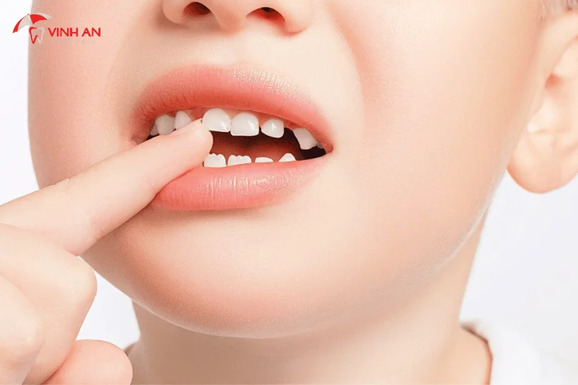 nha khoa trẻ em tphcm, nha khoa trẻ em