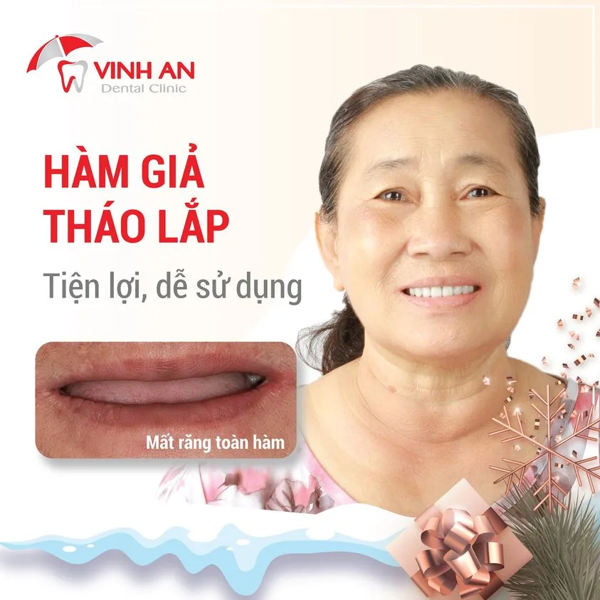 trồng răng sứ không có chân răng