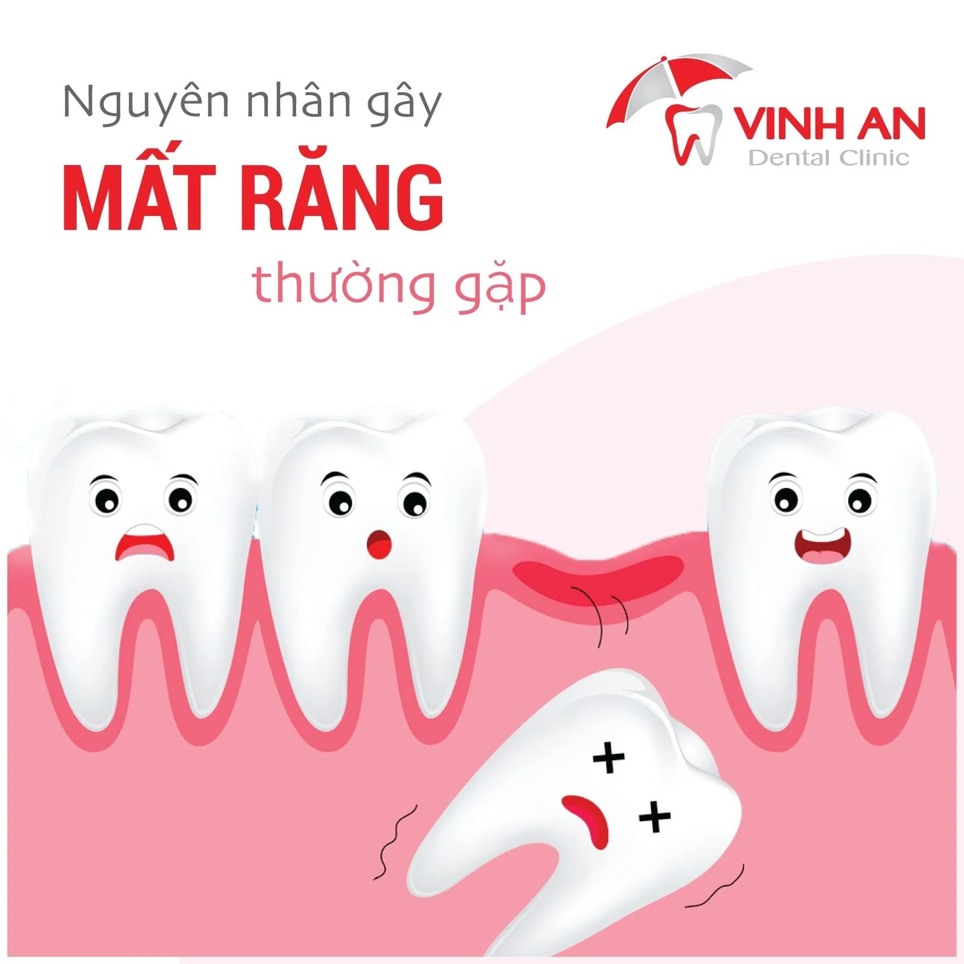 Trồng răng sứ không có chân răng