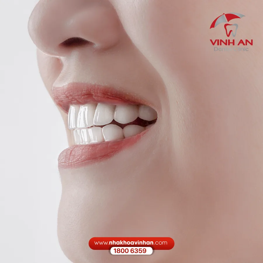 trồng răng sứ không có chân răng