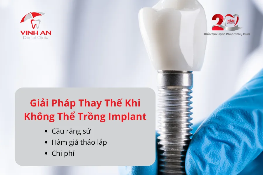 Bao Nhiêu Tuổi Thì Trồng Răng Implant Được 3