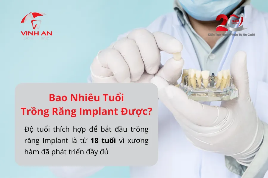 Bao Nhiêu Tuổi Thì Trồng Răng Implant Được_ 1