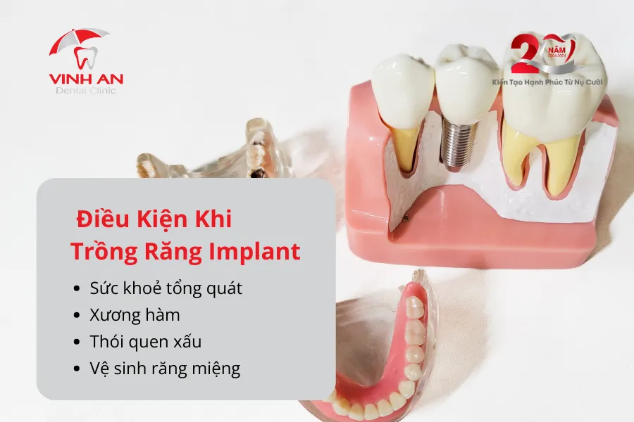 Bao Nhiêu Tuổi Thì Trồng Răng Implant Được_ 2