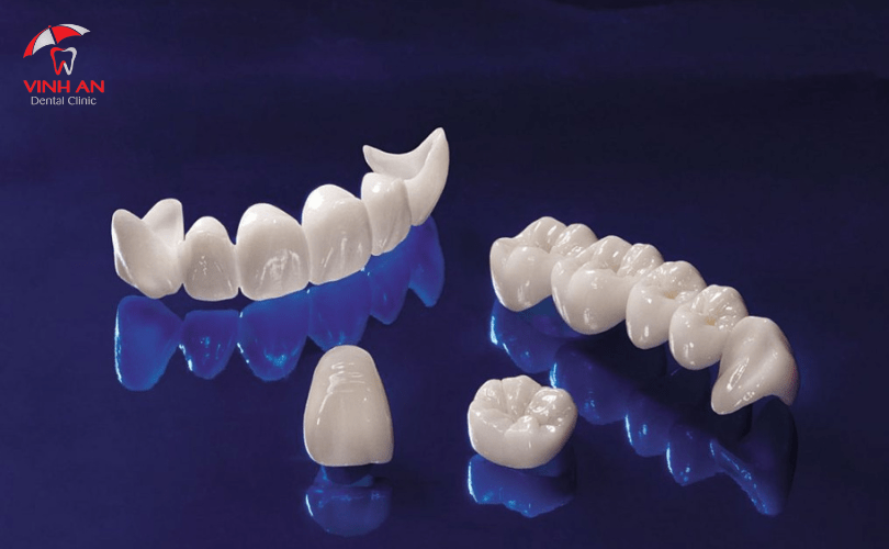 Dòng răng sứ Implant cao cấp