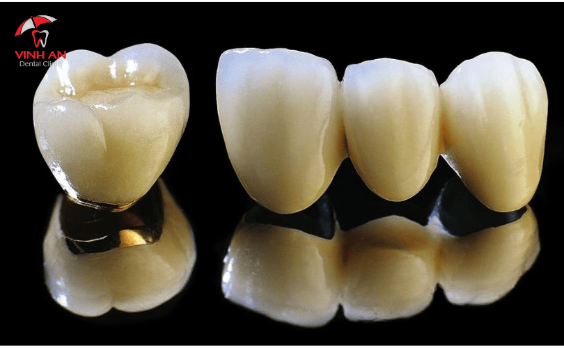 Dòng răng sứ Implant tiêu chuẩn